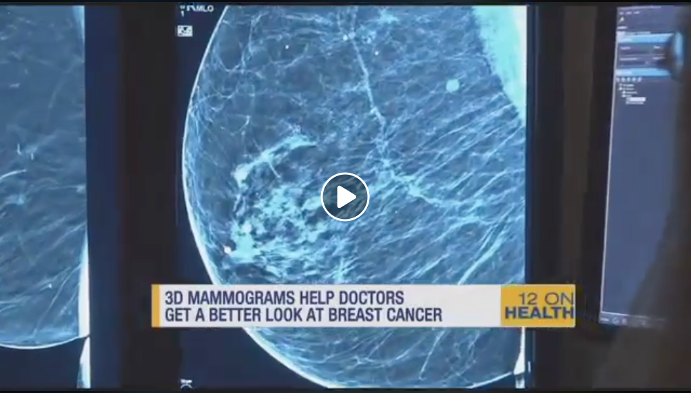 3D Mammography Image