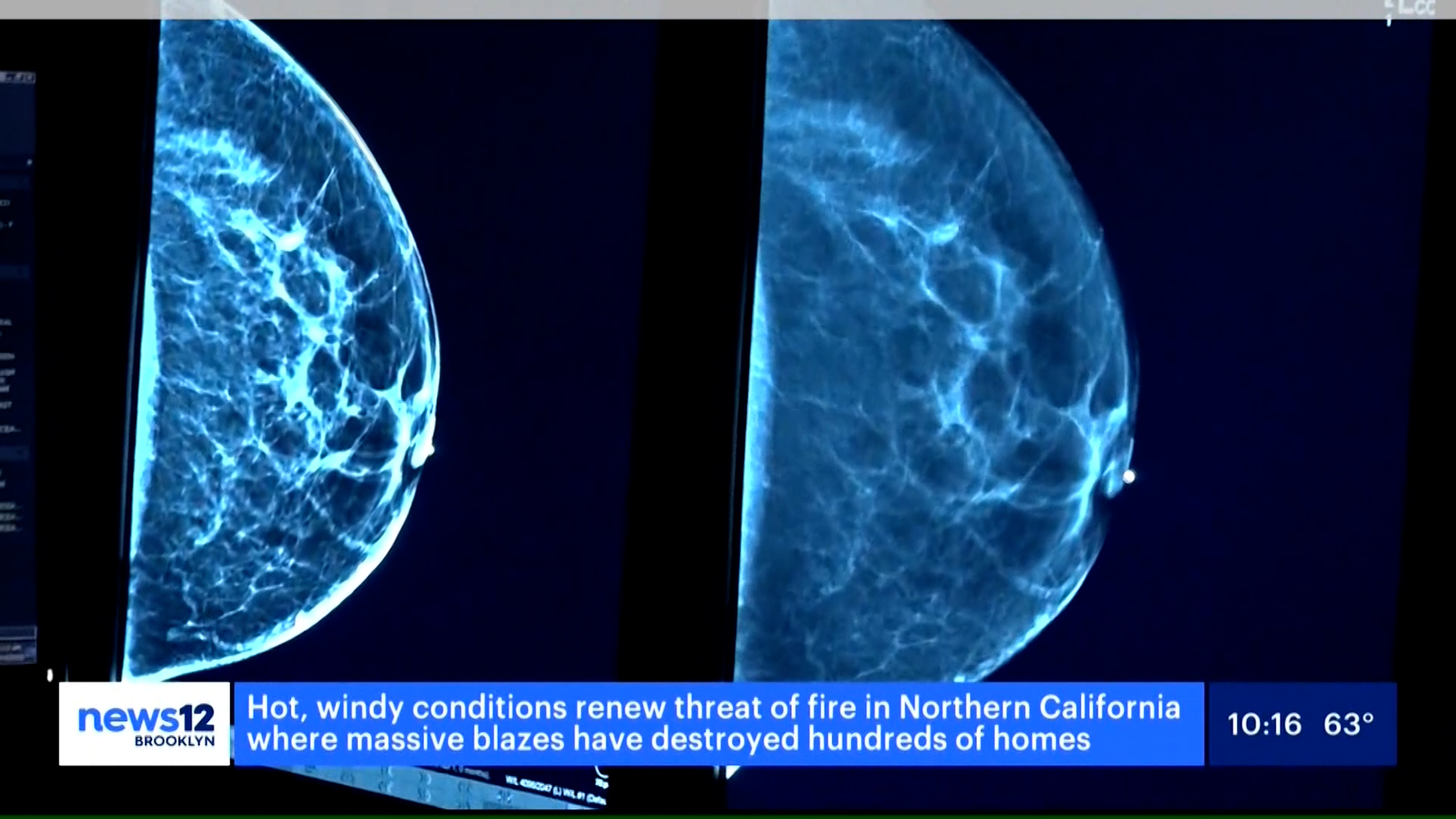 Image of Breast Imaging form SBH Women's Health Center